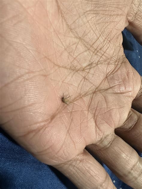 Mosquito problem for weeks. Any tips greatly appreciated! : r/askSingapore