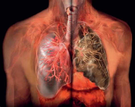 The effects of smoking on the respiratory system - Hodder Education