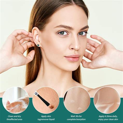 Wart Remover Liquid – Effective Wart Removal with Specialized Formula