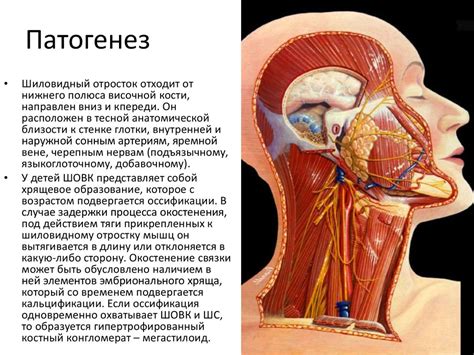 Шилоподъязычный синдром или синдром Игла-Стерлинга - презентация онлайн