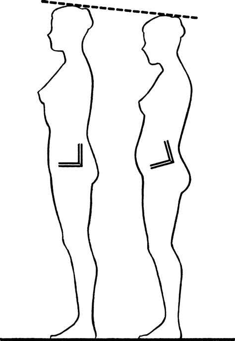 Inclinación pélvica - Wikipedia, la enciclopedia libre