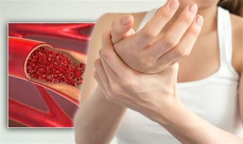 Blood clot in arm: Five changes to your arms that could be symptoms of ...