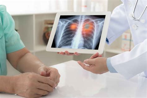 Thoracic Cancer Symptoms: Early Detection and Treatment - Apollo Proton
