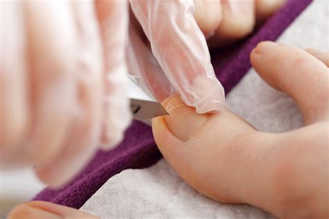 Blog • Wisconsin Foot Center