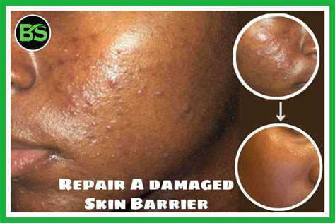 damaged skin repair artofit