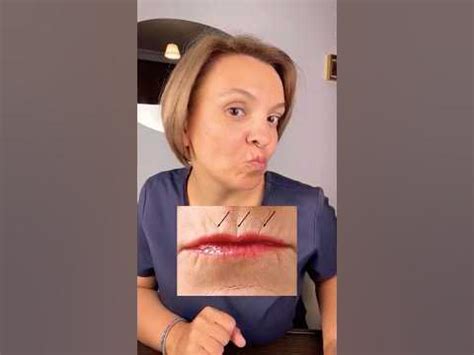 #массажлица от #кисетные #морщины - YouTube