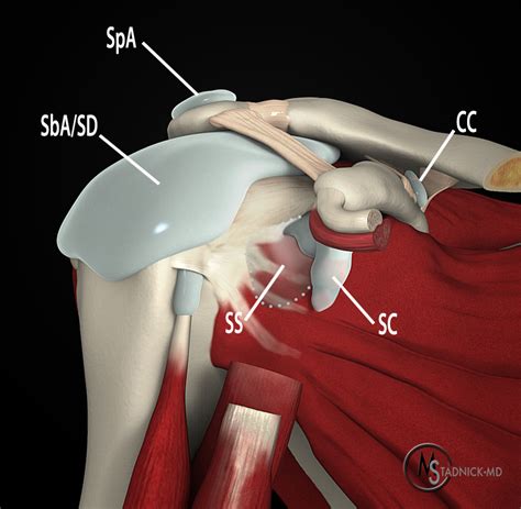 Subcoracoid Bursa | Radsource