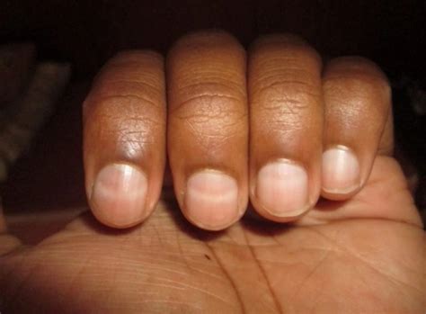 facts  beaus lines factsnet