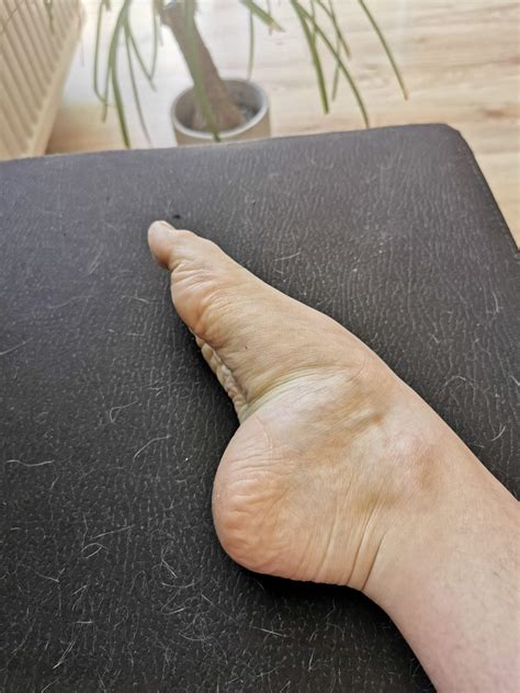 Wie findet ihr meinen Spann? (Gesundheit, Füße, Ballett)