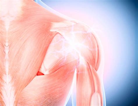 trigger point therapy explained techniques  benefits