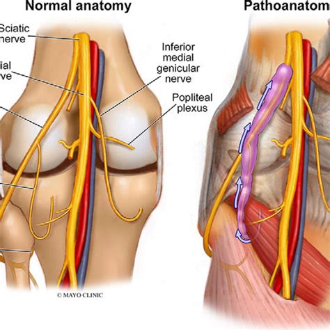 The Hidden Knee Revealing The Complexity And Care Of Posterior Knee Anatomy