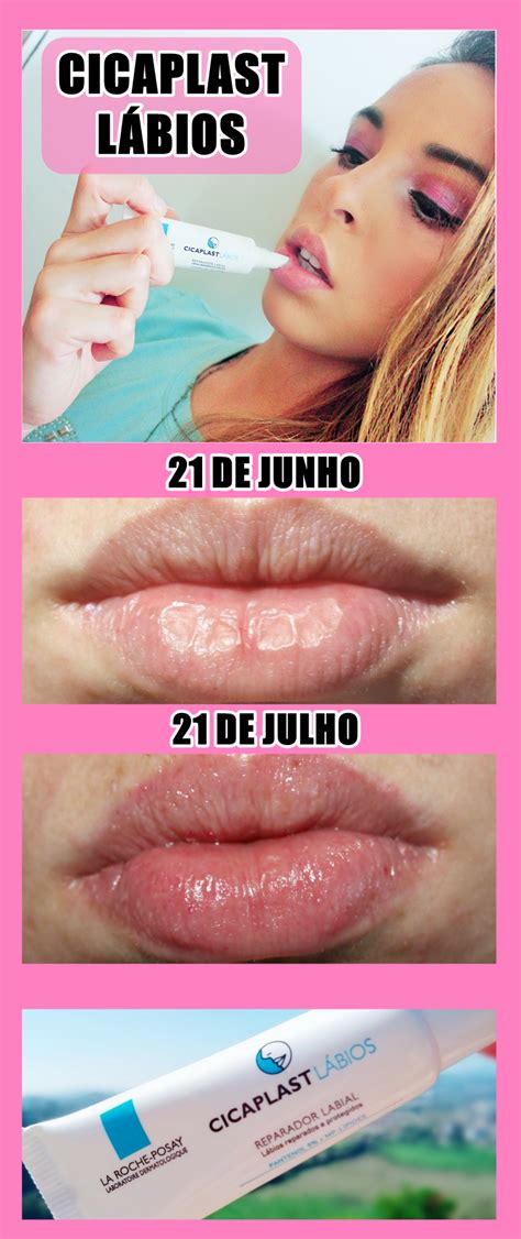 Cicaplast Lábios Antes E Depois - Resultado do teste com cicaplast Lábios Resenha Cicaplast lábios ...