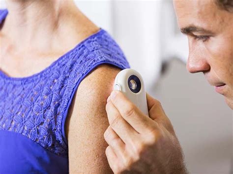 cutaneous horn pictures removal