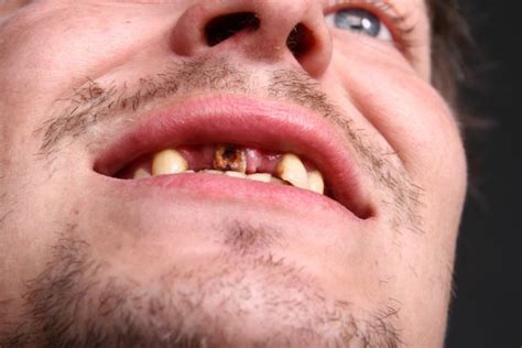 Bad teeth — Stock Photo © v.gi #73356915