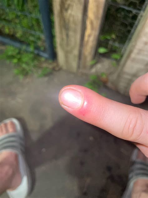 Copperhead Bite When Is A South Carolina Copperhead Likely To Bite