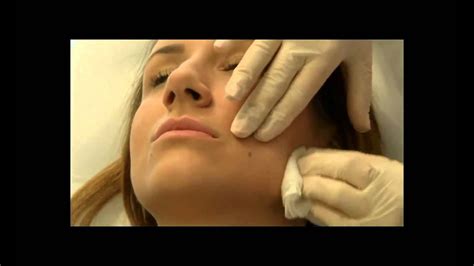 Как да изглеждаш по-млад с филър и мезотерапия How to look younger with ...