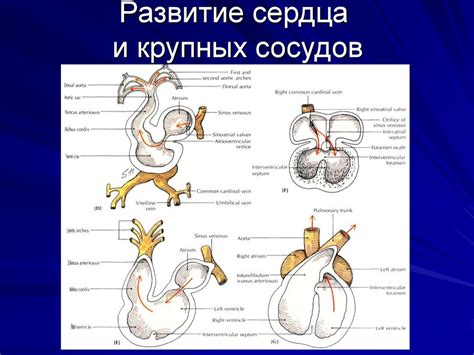 Развитие сердца. Основные аномалии сердечно-сосудистой системы ...