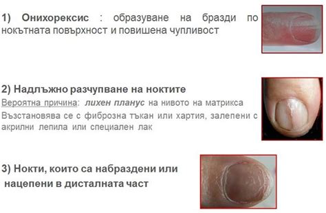 За здрави и красиви коса и нокти. Интервю с д-р Дренски. - Здравословни ...