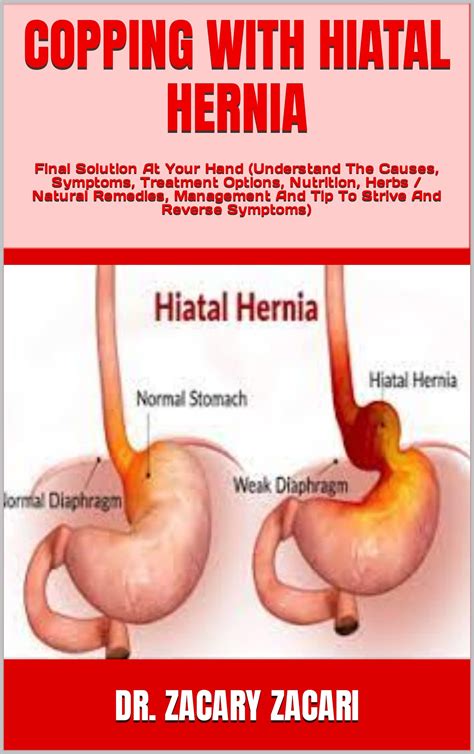 COPPING WITH HIATAL HERNIA : Final Solution At Your Hand by DR. ZACARY