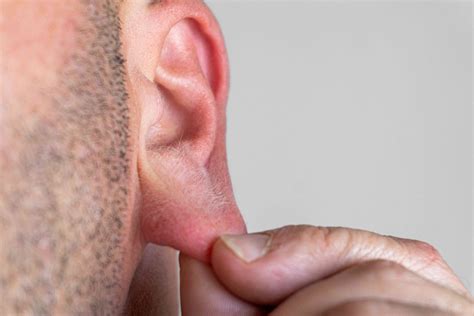 This guide explains why is there a bump on my earlobe 9