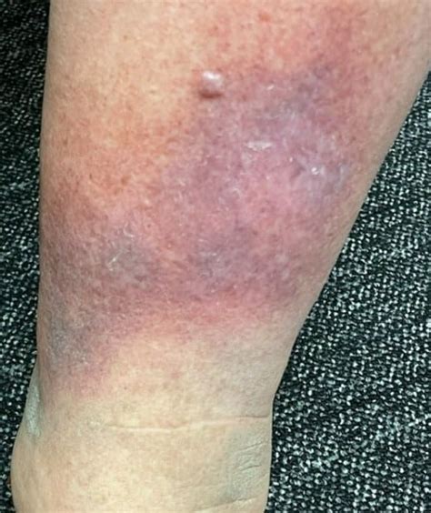 What are the main causes of swollen legs?
