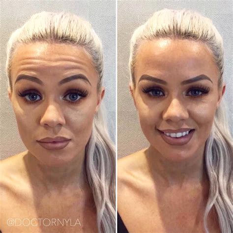 Forum Phun Celebrity Extra: Before & After Results You Have To See! Image 19