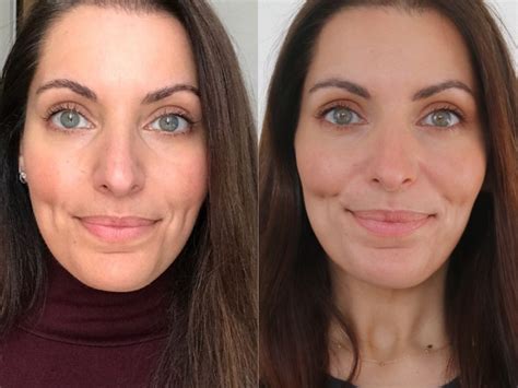 women     hair loss   experts