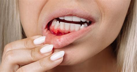 Warning signs you're vitamin deficient and foods that help - from ...