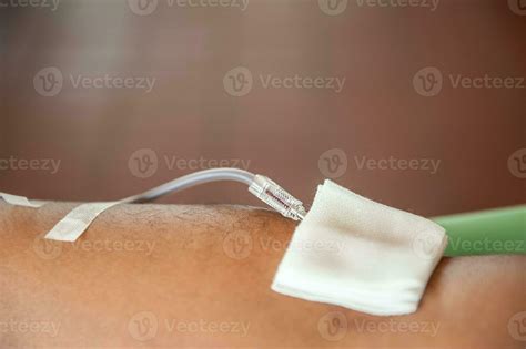 Volunteer to donate blood to help fellow human beings. 20674329 Stock