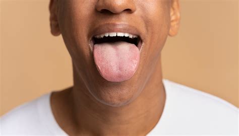 Lingua Verde O Que Pode Ser - Alterações na língua podem significar doenças