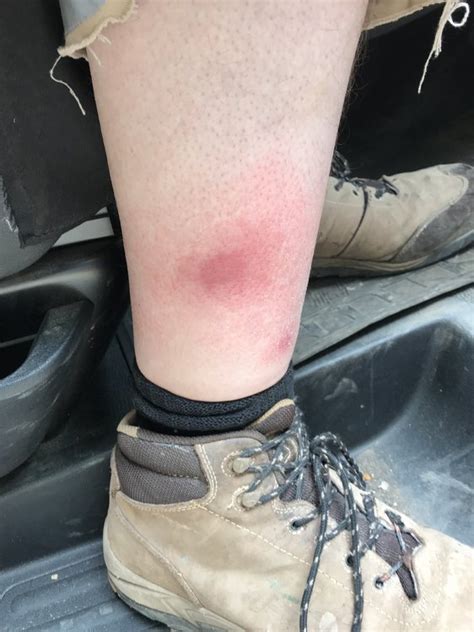 Horse fly bite - Off Topic - Pigeon Watch Forums