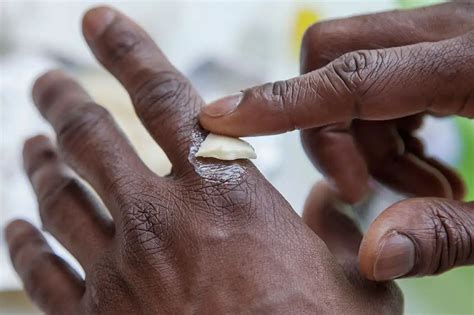 How to Get Super Glue Off Skin - 6 Easy Steps | Cleanipedia UK