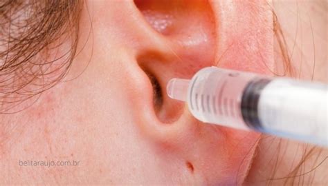 Como Desentupir O Ouvido Com Cera - Cera No Ouvido: Como Desentupir E Limpar Cera De Ouvido Em Casa – Bélit ...