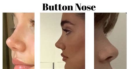 Button Nose Shape