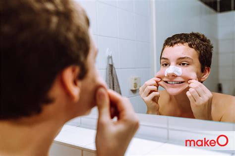 common skin issues  men