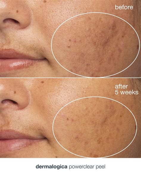 our services - Dermalogica PRO UK