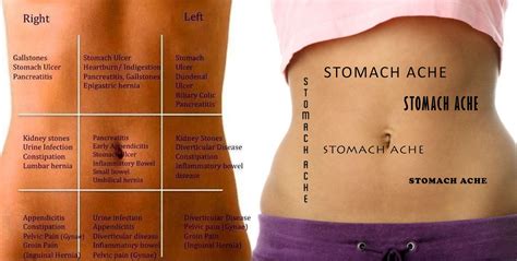 stomach pain   call abdominal pain information mvjel