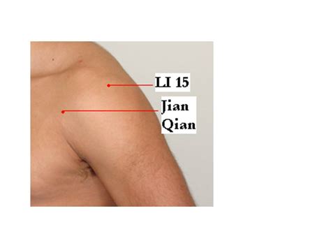 59. Frozen Shoulder and Acupuncture Treatment « Jun Xu, M.D. (203) 637 ...