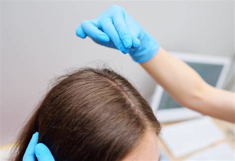 Hair Pull Test: What Is It And Why It's Important? - iRESTORE Laser