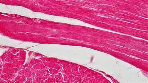 muscle tissue cross section  skeletal muscle flickr