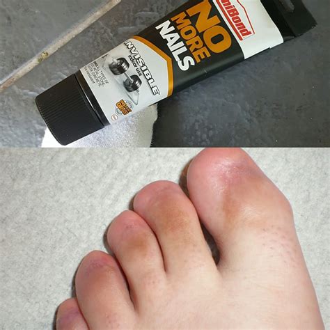 Dropped this on my foot! Really does work : r/funny