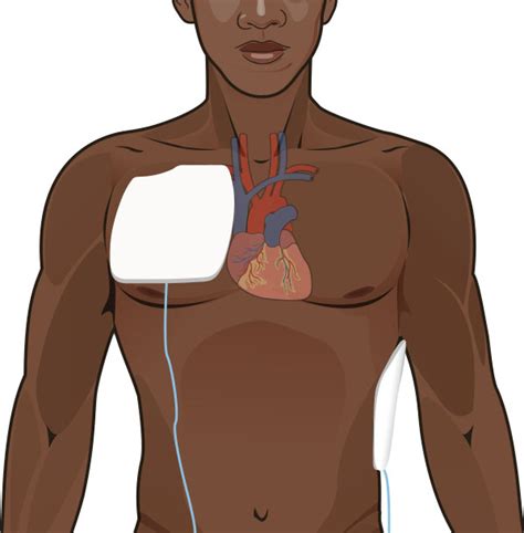 35.2: Cardiovascular Concerns - Medicine LibreTexts