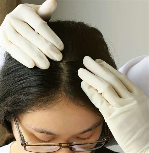 Fun Tips About How To Treat Scalp Pimples - Commonlab23