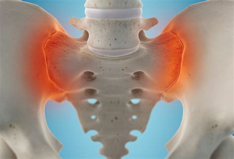 SI Joint Treatment In Ottawa | Oaktree