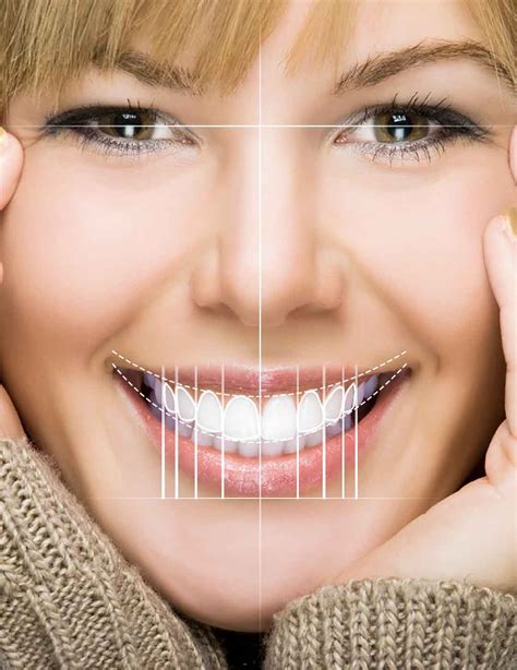 Digital Smile Design (DSD) Dubai - Co-Design Your New Smile - Dental Studio