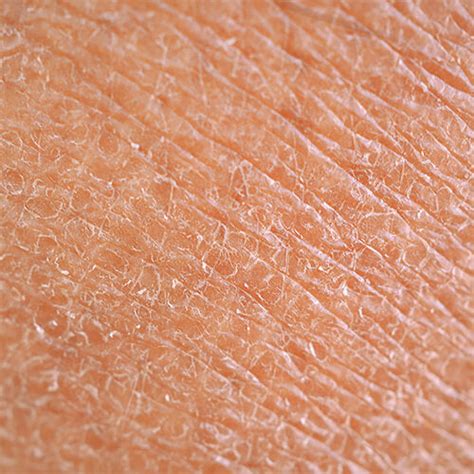 essential tips    skin youthful  hydrated  winter
