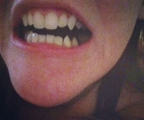 Fang teeth | Stylist tattoos, Teeth, Fang