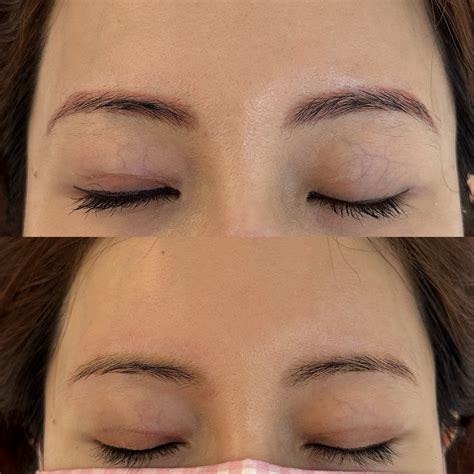 Clean Removal, Clear Skin: The Safest Way to Erase Unwanted Brows in