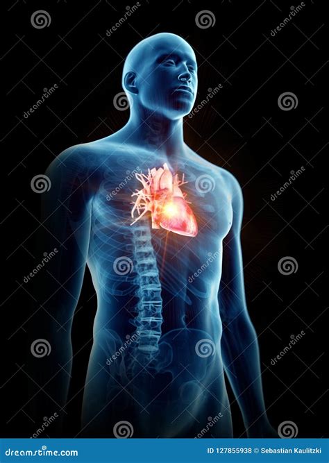 A painful heart stock illustration. Illustration of cardiac - 127855938