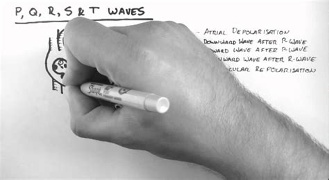ecg  pqrs  waves youtube